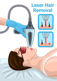 ~The Advancements and Benefits of Laser Hair Removal Technology!